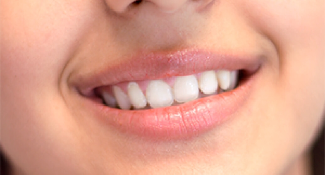 Ästhetische Zahnheilkunde in Buchholz - Weiße Zähne und strahlendes Lächeln